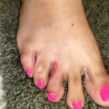 Famous Nails and Spa - Burn hours after the appointment - Nail Salons Near Me - Lompoc, California Famous Nails and Spa - Burn hours after the appointment - Nail Salons Near Me - Lompoc, California