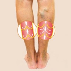 Vein and Laser Center