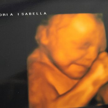 Babes & Bellies - Ultrasound Imaging Centers Near Me - Long Beach, California Babes & Bellies - Ultrasound Imaging Centers Near Me - Long Beach, California