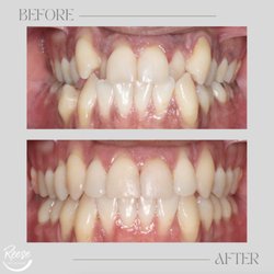 Reese Orthodontics - Amazing results!