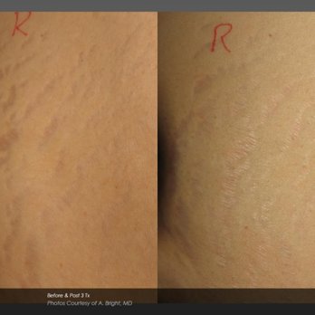 Trimedica Spa - Tattoo Removal Near Me - Farmingville, New York Trimedica Spa - Tattoo Removal Near Me - Farmingville, New York