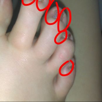 Gel Nails & Spa - This was taken less than 2 hours after my "pedicure". - Nail Salons Near Me - Kansas City, Missouri