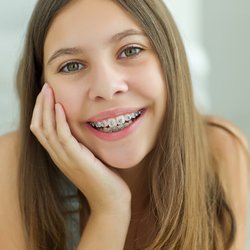Altherr Orthodontics - Teen in braces
