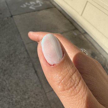 DAT Nail Salon - Bleeding cuticle even after the manicure was done - Massage Near Me - San Francisco, California DAT Nail Salon - Bleeding cuticle even after the manicure was done - Massage Near Me - San Francisco, California
