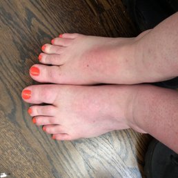 Pedicare