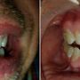 Photo of Showstoppers Teeth Whitening Studios