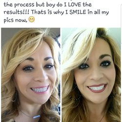 Creating Smiles Dentistry - Sooo happy with my results!