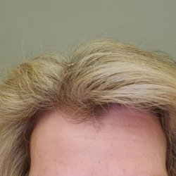 Allure Medical