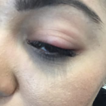DB Lash Beauty Studio - She said this is normal! An infection! - Eyelash Service Near Me - Tustin, California