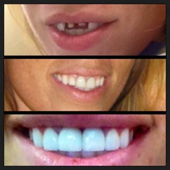 Mirelez Wellness Dental - Cosmetic Dentists Near Me - Fresno, California