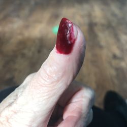 Mozoe Nails Spa - This is what my thumb looked like when I went in today.