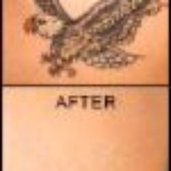 Northampton Laser Clinic
