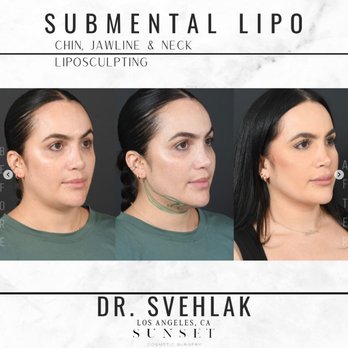 Sunset Cosmetic Surgery - Cosmetic Surgeons Near Me - West Hollywood, California Sunset Cosmetic Surgery - Cosmetic Surgeons Near Me - West Hollywood, California