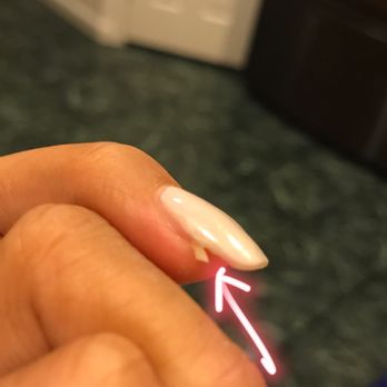 Pro Nails - Natural nail broken underneath fake nail (mismatched sizing) - Nail Salons Near Me - Elk Grove, California Pro Nails - Natural nail broken underneath fake nail (mismatched sizing) - Nail Salons Near Me - Elk Grove, California