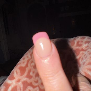 Elite Nail Spa - Redness around cuticles - Nail Salons Near Me - Acworth, Georgia