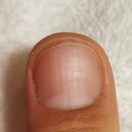 Wonky nail cut Wonky nail cut