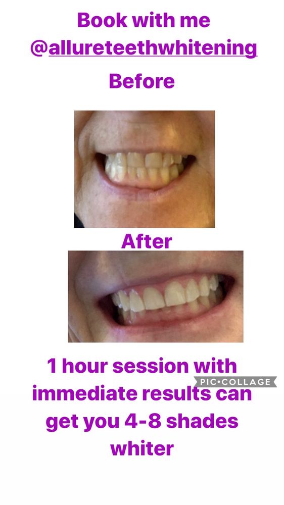 Allure Teeth Whitening Logo