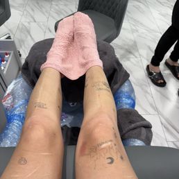 The pedicure