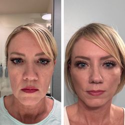 Blackledge Face Center