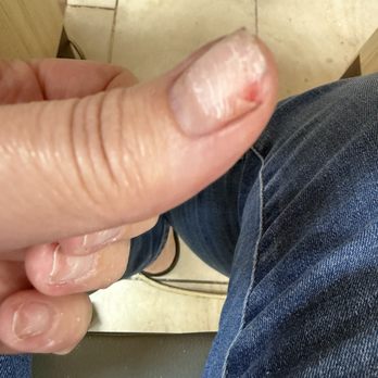 Mimi's Nails - This picture is where they ripped my nail , trying to use an artificial fingernail to pry off my acrylic nail. - Nail Salons Near Me - Modesto, California Mimi's Nails - This picture is where they ripped my nail , trying to use an artificial fingernail to pry off my acrylic nail. - Nail Salons Near Me - Modesto, California