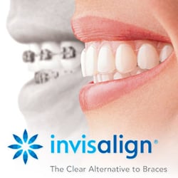 Isaacson Orthodontics - Invisalign
