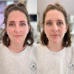 Before and after photos. After about 2 weeks, the color settled in to a much more natural color that matches my hair perfectly! Before and after photos. After about 2 weeks, the color settled in to a much more natural color that matches my hair perfectly!