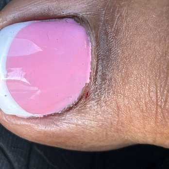 D's House Nails - You can see where the tech cut me. They basically told me I'm lying. Not going to fly - Nail Salons Near Me - Pleasant Hill, California D's House Nails - You can see where the tech cut me. They basically told me I'm lying. Not going to fly - Nail Salons Near Me - Pleasant Hill, California
