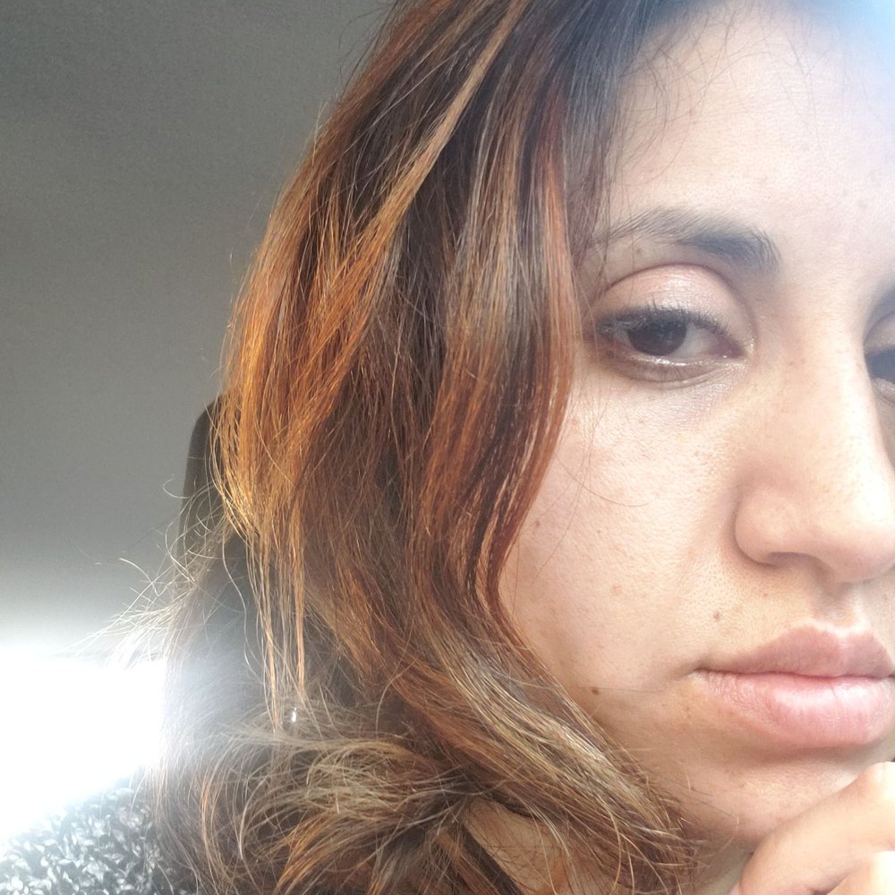 salon87 - Orange spots before the correction - Hair Stylists Near Me - Chicago, Illinois