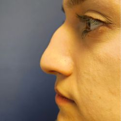 Robert Bridge, MD - Before