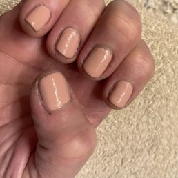 Example of the bad edges and cuticle line.