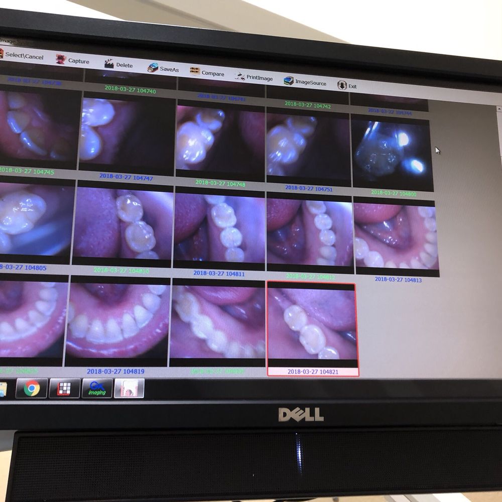 Photos with camera. Clean, happy mouth