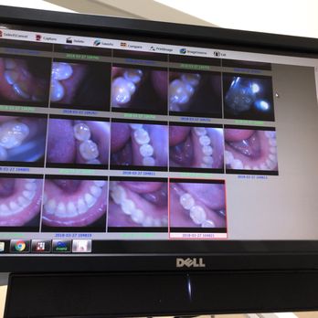 Beverlywood Dental - Photos with camera. Clean, happy mouth - General Dentistry Near Me - Los Angeles, California