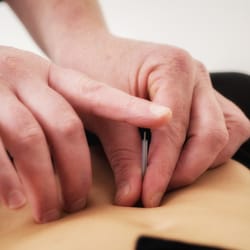 Oded Schneiderman Acupuncture