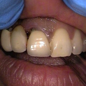 Brian Y Kuo, DDS - Years ago - General Dentistry Near Me - Arcadia, California Brian Y Kuo, DDS - Years ago - General Dentistry Near Me - Arcadia, California