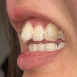 Family Orthodontics & Oral Surgery - Side view