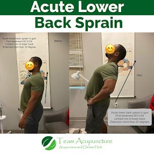 Team Acupuncture - Boca Raton gift card