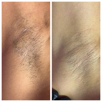 The Almighty Experience Salon - Underarm Wax
By Ary - Teeth Whitening Near Me - Phoenix, Arizona The Almighty Experience Salon - Underarm Wax
By Ary - Teeth Whitening Near Me - Phoenix, Arizona