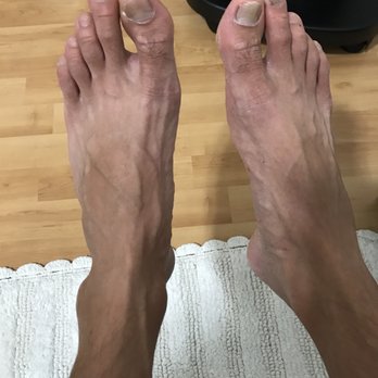 Serendipity Nail n Beauty bar - My hubby's feet before treatment. Nails def needed cleaning. - Nail Salons Near Me - Honolulu, Hawaii Serendipity Nail n Beauty bar - My hubby's feet before treatment. Nails def needed cleaning. - Nail Salons Near Me - Honolulu, Hawaii