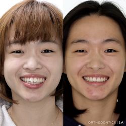 Orthodontics LA