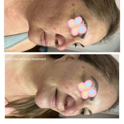 Yuyan Beauty - You don't know how beautiful you skin would look like after my Ice Resculpting facial!
