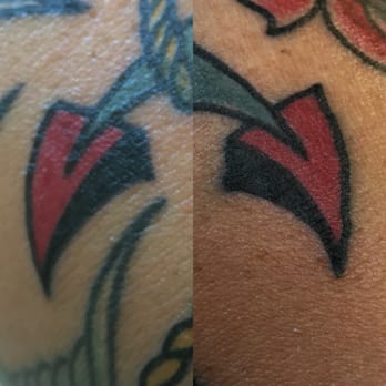 Tattoo Paradise - inconsistent sides of the anchor - it's like two different people did it - horrible - Tattoo Near Me - Washington, DC, District of Columbia Tattoo Paradise - inconsistent sides of the anchor - it's like two different people did it - horrible - Tattoo Near Me - Washington, DC, District of Columbia