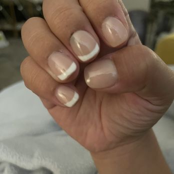 Chloe Nails - 3 days later scabs are healing. Missing gel on thumb and index. - Nail Salons Near Me - Lomita, California Chloe Nails - 3 days later scabs are healing. Missing gel on thumb and index. - Nail Salons Near Me - Lomita, California