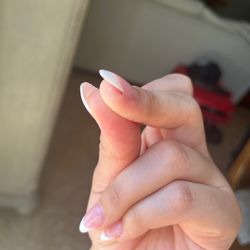 VS Nails & Spa - You can't really see it in the pic but the cut is deep and swollen