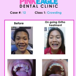 Pink Eagle Dental Clinic