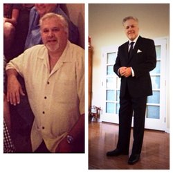 Abdul Nawabi, MD - Actual patient Before and After weight loss program