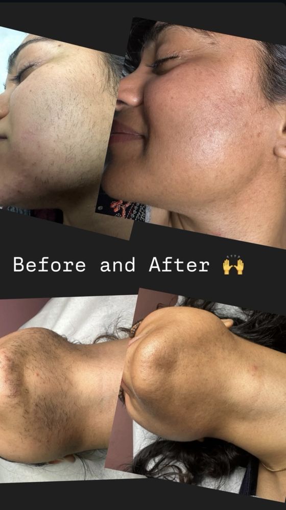 Flawlyss Electrolysis By Gina Logo