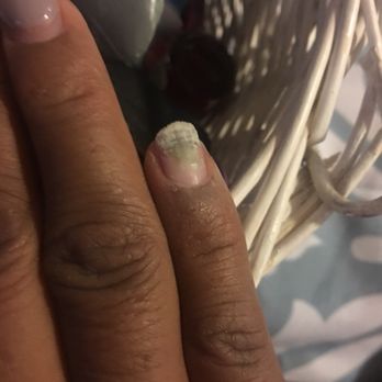 Fantasy Nails - 1st one removed & I wanted to pass out. Not knowing there was still more. - Nail Salons Near Me - San Jose, California