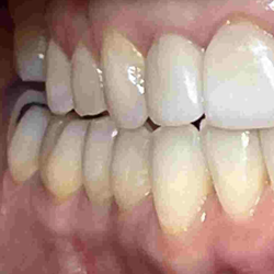 Holliday Dental