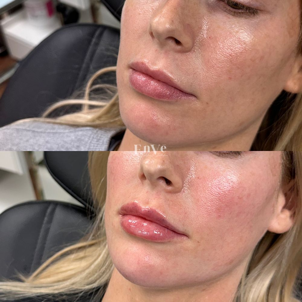 Enve California Aesthetics Logo