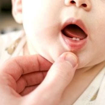 Austin Children's Dentistry - Austin - Early Dental Care in Austin, TX - Pediatric Dentists Near Me - Austin, Texas Austin Children's Dentistry - Austin - Early Dental Care in Austin, TX - Pediatric Dentists Near Me - Austin, Texas